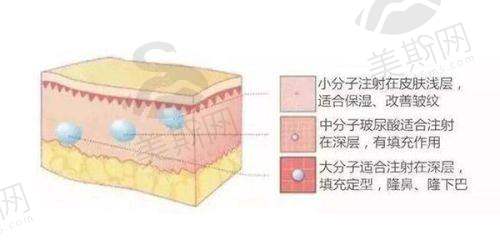 特色项目