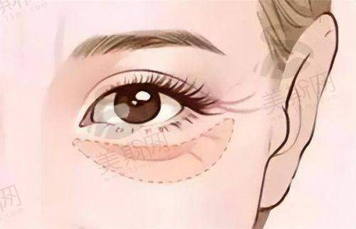 湖州昊兴曙光威兹曼医美门诊部2025年价格表