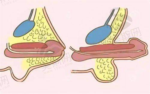 南京红颜会医疗美容诊所2025年价格表