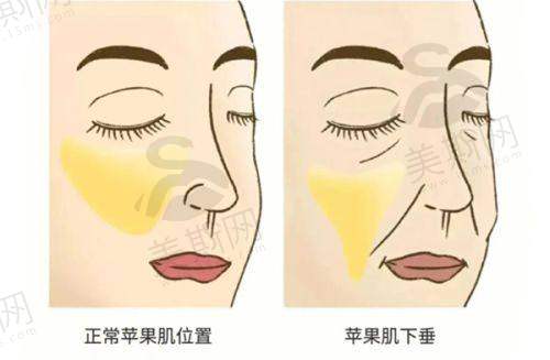 北京亚楠容悦医疗美容诊所肋软骨隆鼻15000元起,双眼皮6000元起等项目价格公布