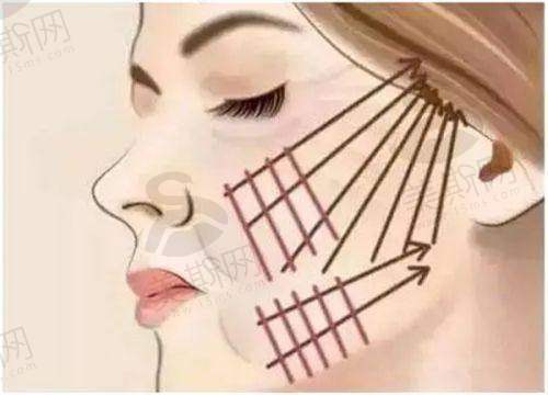 北京亚楠容悦医疗美容诊所2025年价格表