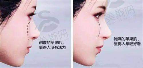 北京南加医疗美容门诊部自体脂肪移植、眼鼻修复、面部年轻化等项目价格合理优惠