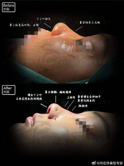 王旭明医生收费标准合理