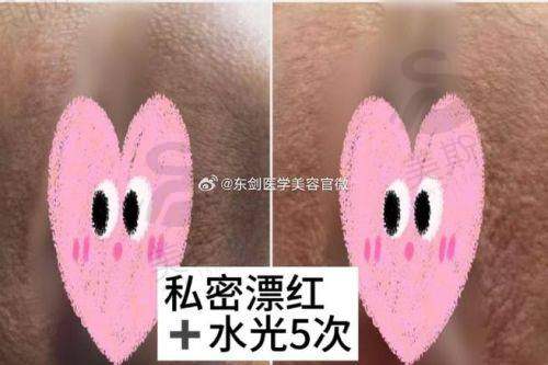 重庆军科整形VS华美整形医生