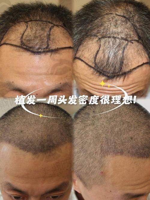总结