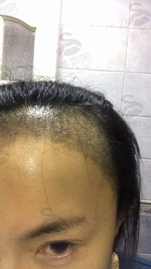 昆明十大正规大型整形医院技术优势