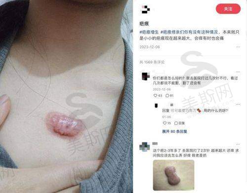上海瑞椿(健桥)疤痕科医院收费贵吗?