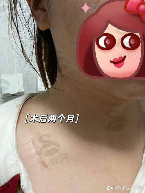 上海瑞椿(健桥)疤痕科医院是国有的吗?
