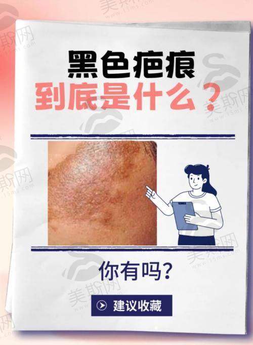 上海瑞椿(健桥)疤痕科医院预约挂号