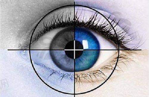 医疗保险报销+省钱攻略:弱视治疗能省多少钱?