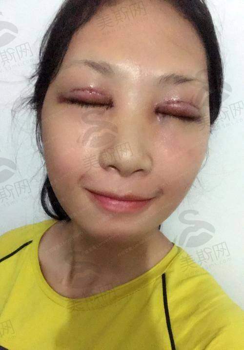 上海绿之星医疗美容医院口碑如何