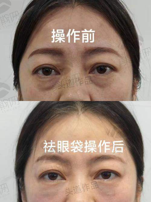 上海绿之星医疗美容医院诊疗项目