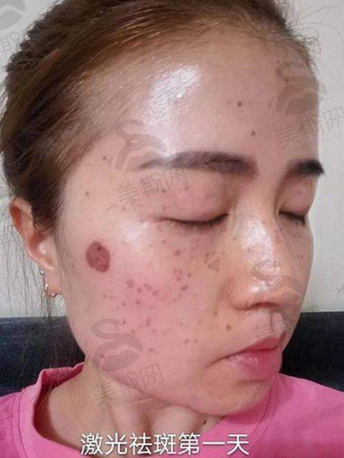 上海绿之星医疗美容医院正规吗?