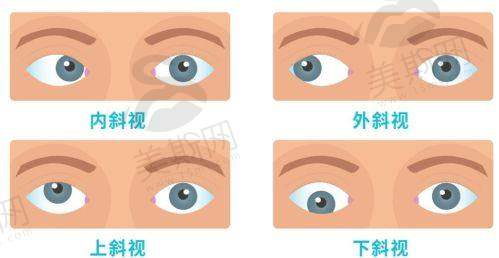 西宁爱尔眼科医院近视手术医生实力大揭秘