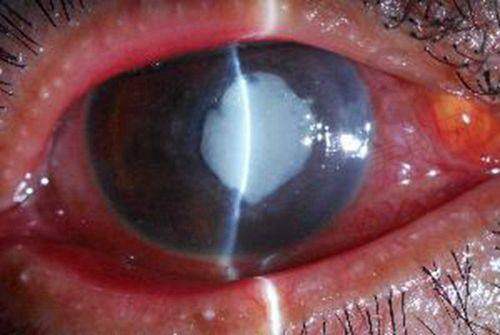 五邑中医院眼科