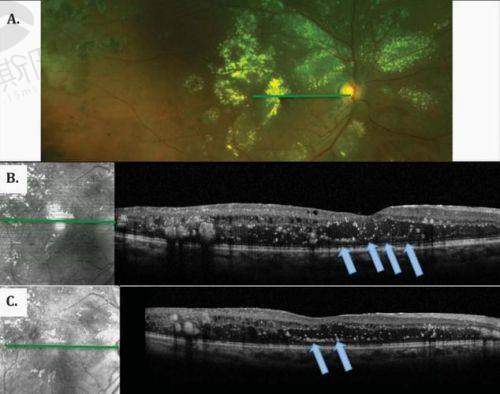 【北京同仁医院眼科视网膜血管病变医生排名】top10专家技术强！魏文斌/马东丽出诊时间+收费标准公布