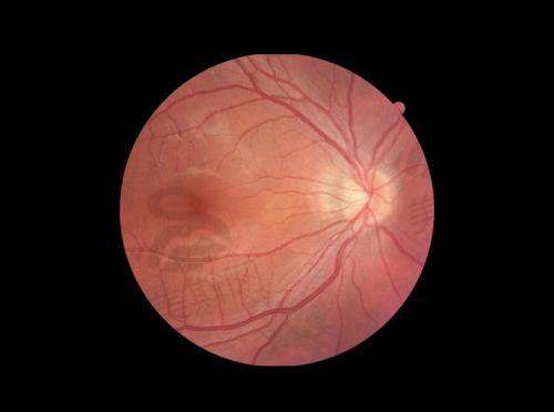 2025年治疗费用明细:从检查到手术,每一分钱都花在刀刃上