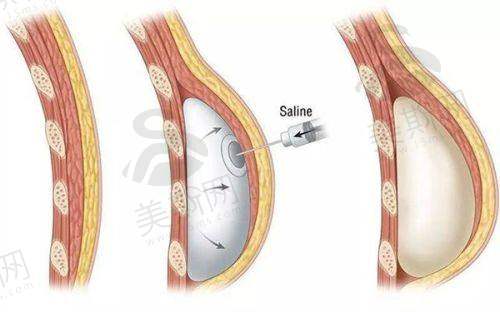 真实实例分享：这些姐妹在九院变得更美后，人生都开挂了！