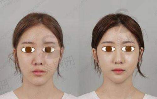 上海九院整形科院长是谁?2025美容整形外科权威专家技术精湛口碑佳(附医生介绍)!