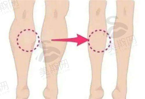 上海九院整形科预约攻略——地址电话+抢号技巧，教你轻松约到骨干医生