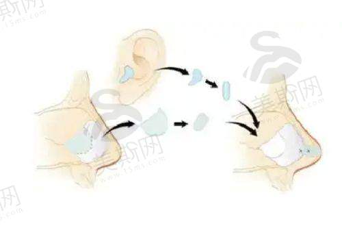 上海九院美容整形外科医生技术强？——名咖云集，每个都是