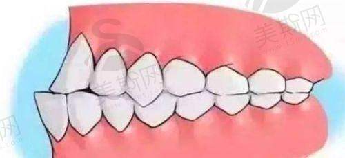 深圳穗华口腔医院急诊要多少钱?费用全解析!