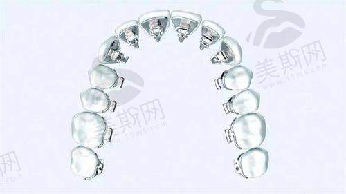 穗华口腔医院贵不贵?急诊性价比大比拼!