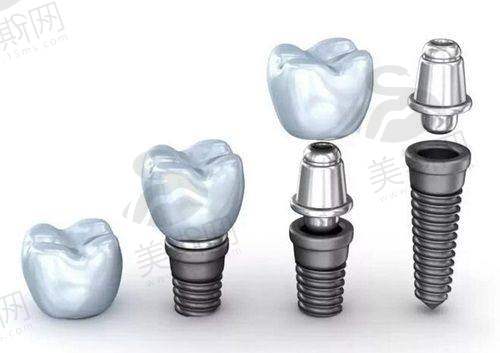 深圳穗华口腔医院有急诊吗？24小时人工服务+专业应急处理，为您口腔健康保驾护航！