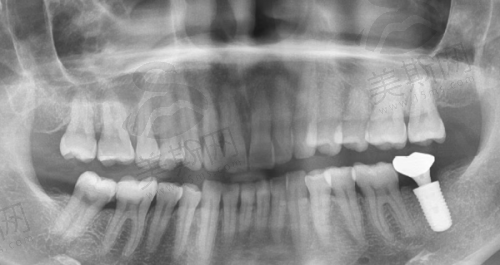 穗华口腔医院可以用医疗保险吗?急诊费用能报销吗?