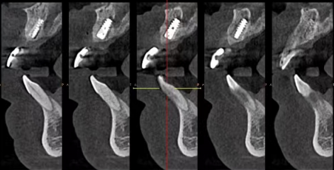 深圳穗华口腔医院24小时人工服务,随时守护您的口腔健康!