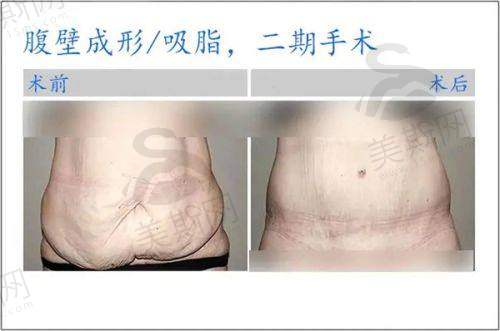 总结：上海九院整形科口碑怎么样？答案只有一个——选它！