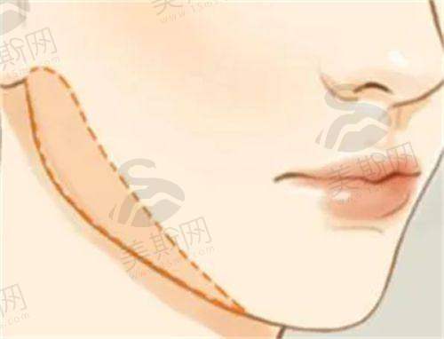 上海九院整形科适合人群：对照看看，你是不是九院的“天选求美者”？