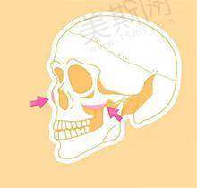 真实患者怎么说？——从修复失败到逆袭，这些实例太戳心