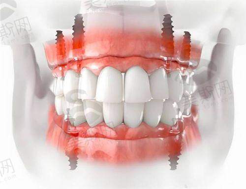 穗华口腔哪个医生好一点?具有影响力推荐来啦!