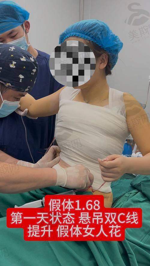 北京协和医院整形科挂号平台收费标准:普通号/特需号/医疗部,怎么选不花冤枉钱?