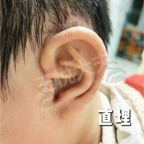 北京协和医院整形科挂号平台抢号攻略:5大技巧帮你“秒杀”骨干医生号