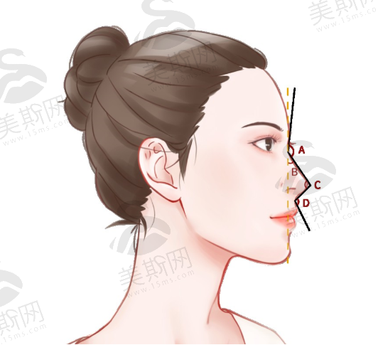 成都素美医疗美容卢元刚院长混血软糖鼻项目价格2万起效果超惊艳！你还不来看？